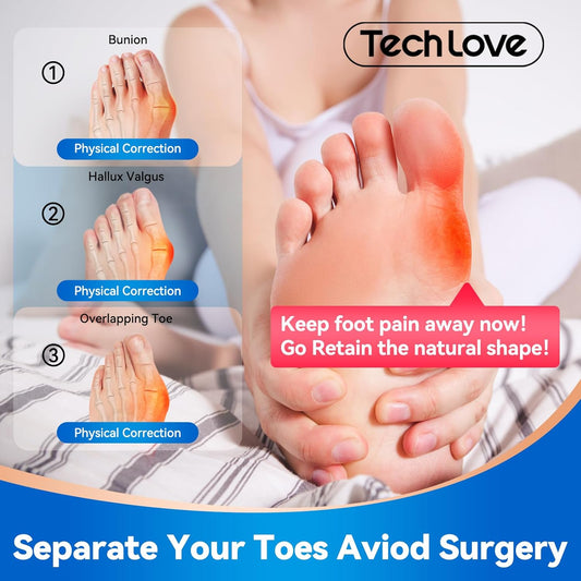 Tech Love Correction of bunions, how to correct them, show