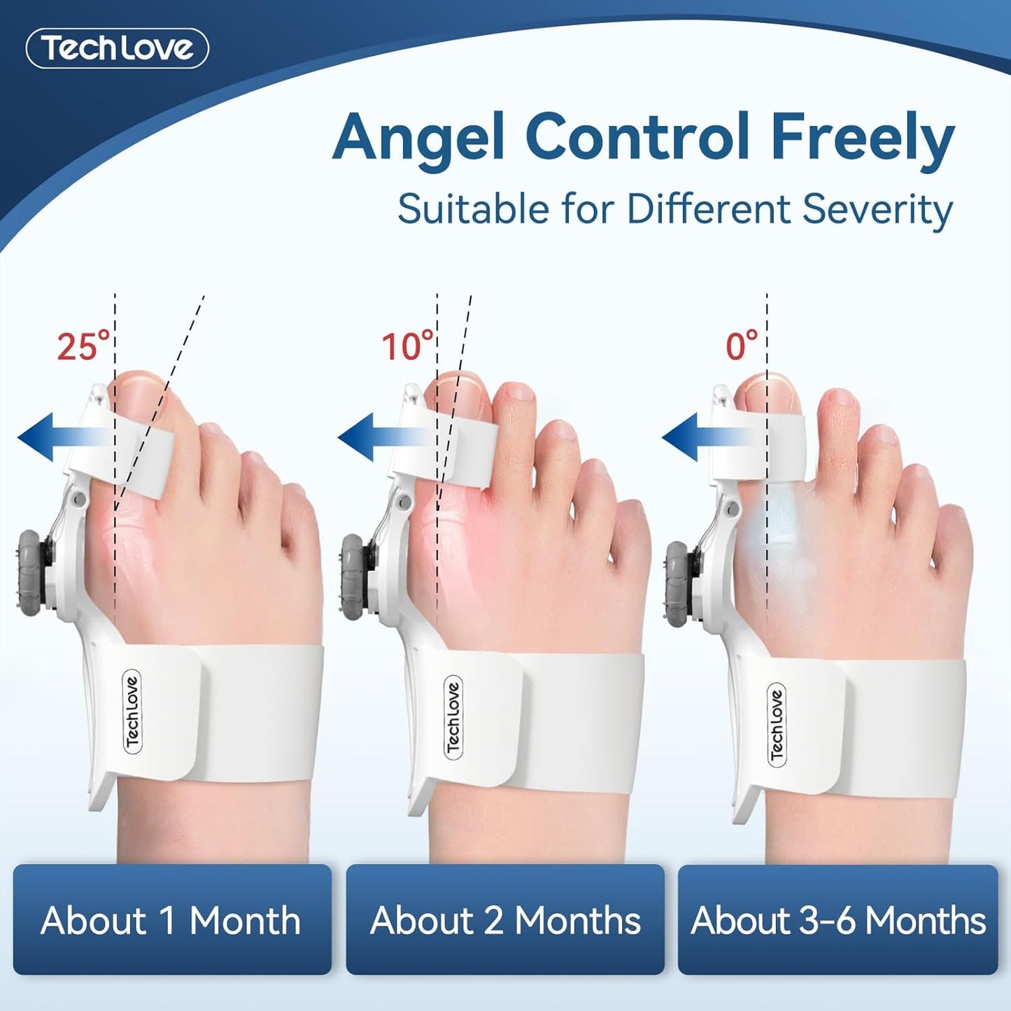 TENICORE Adjustable Bunion Splint - Day & Night Support