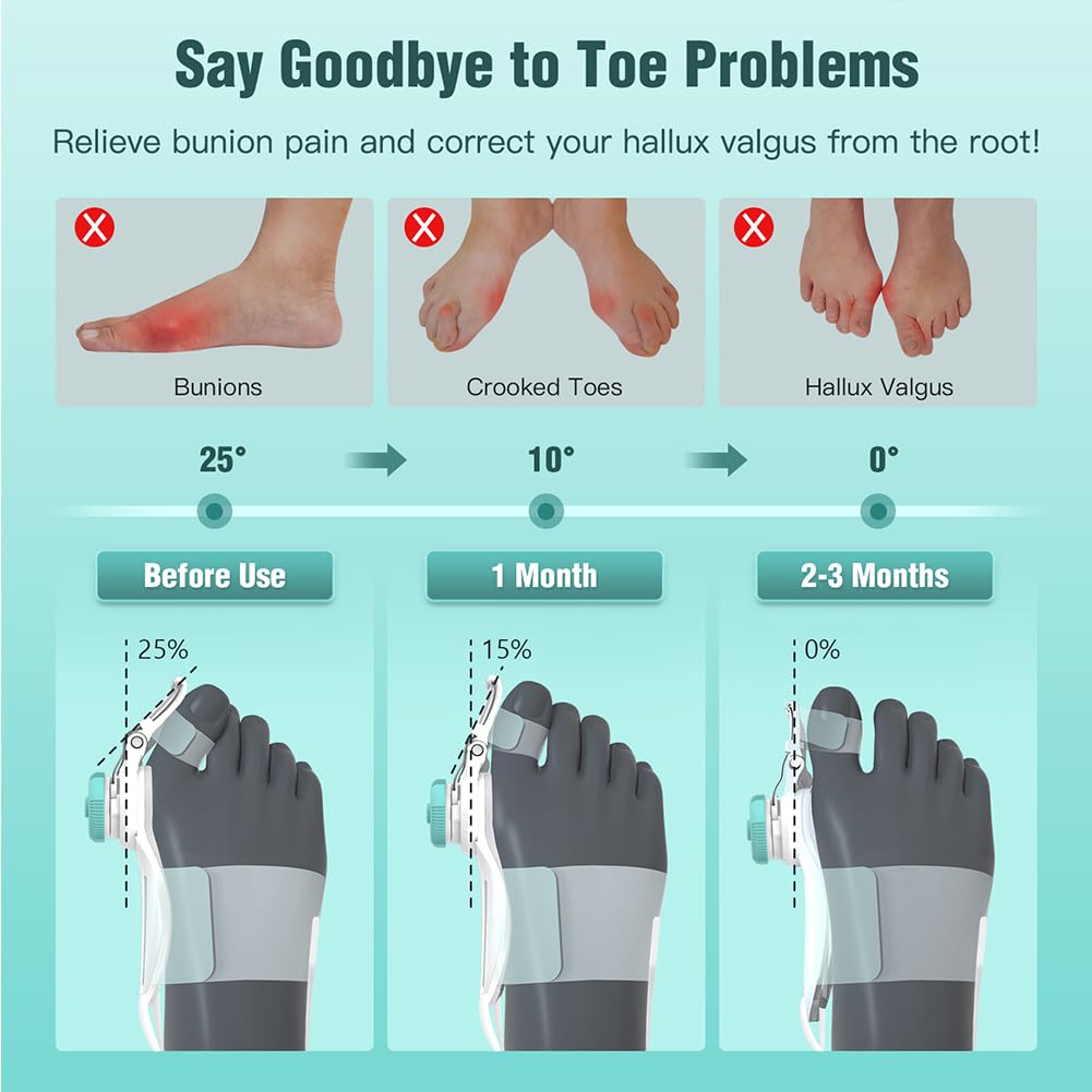 TENICORE Best Bunion Corrector Adjustable Knob Bunion Splint for Bunion Relief