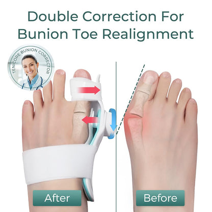 TENICORE Big Toe Orthosis & Hallux Valgus Correction Bunion Splint