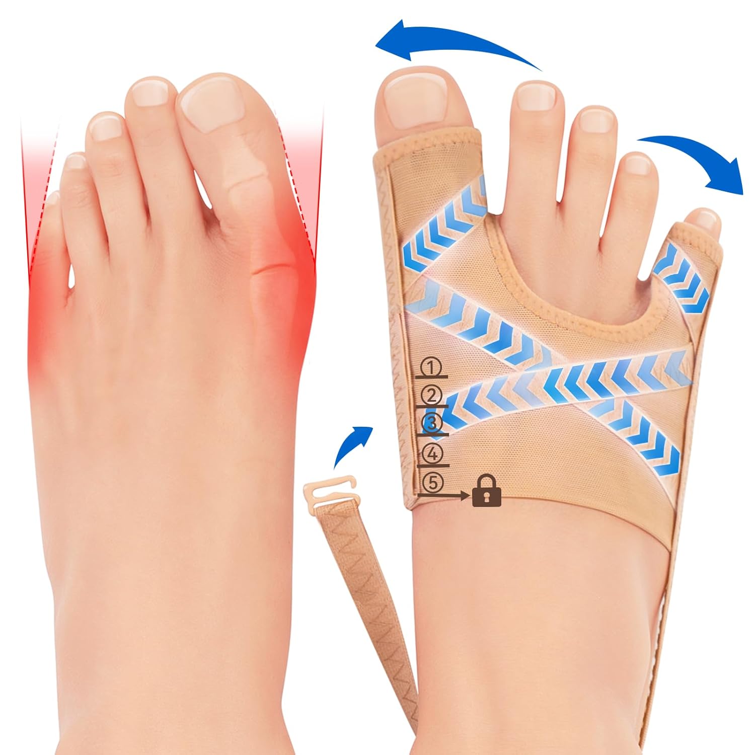 The improvement process from the first day of use to long-term wear clearly demonstrates the positive changes in the gradual correction of hallux valgus angle, establishing reasonable expectations for users.