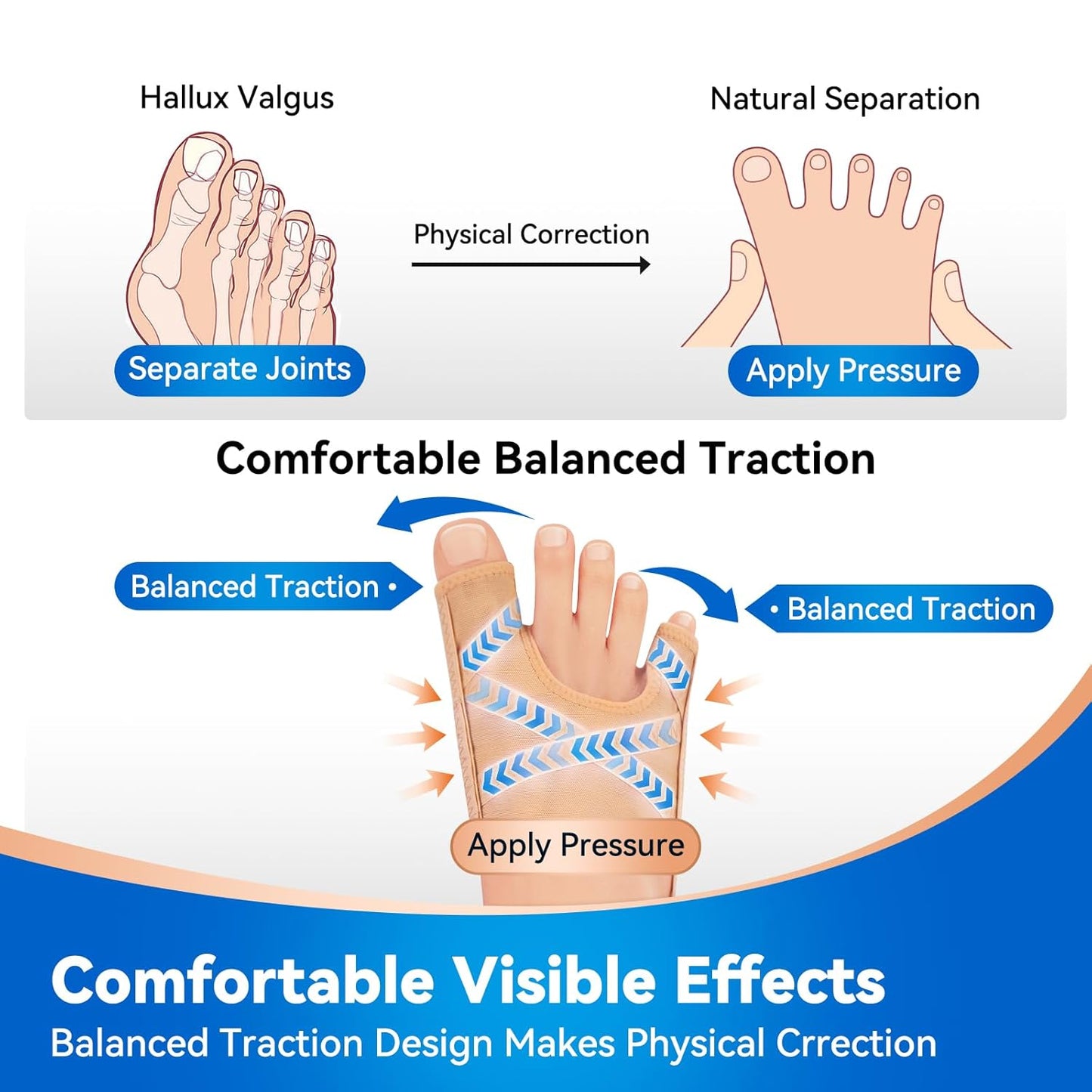 TechLove gently and continuously separates compressed joints through evenly distributed traction. A user who had long suffered from hallux valgus was pleasantly surprised to find that, while wearing the device comfortably, the angle of their toes had visibly improved.