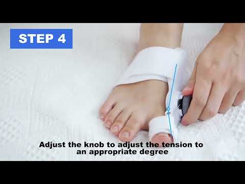 A Tenicore fan is currently testing the Tenicore Bunion Corrector, documenting the process of correcting hallux valgus from various angles and demonstrating the correction achieved from each perspective.
