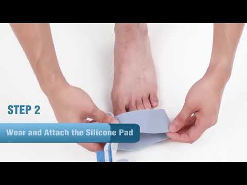 A man suffering from bunions is wearing the Tenicore Bunion Corrector and experiencing the benefits of the product firsthand. He demonstrates the wearing process and the corrected size, noting that he experiences no pain while walking and is gradually recovering.