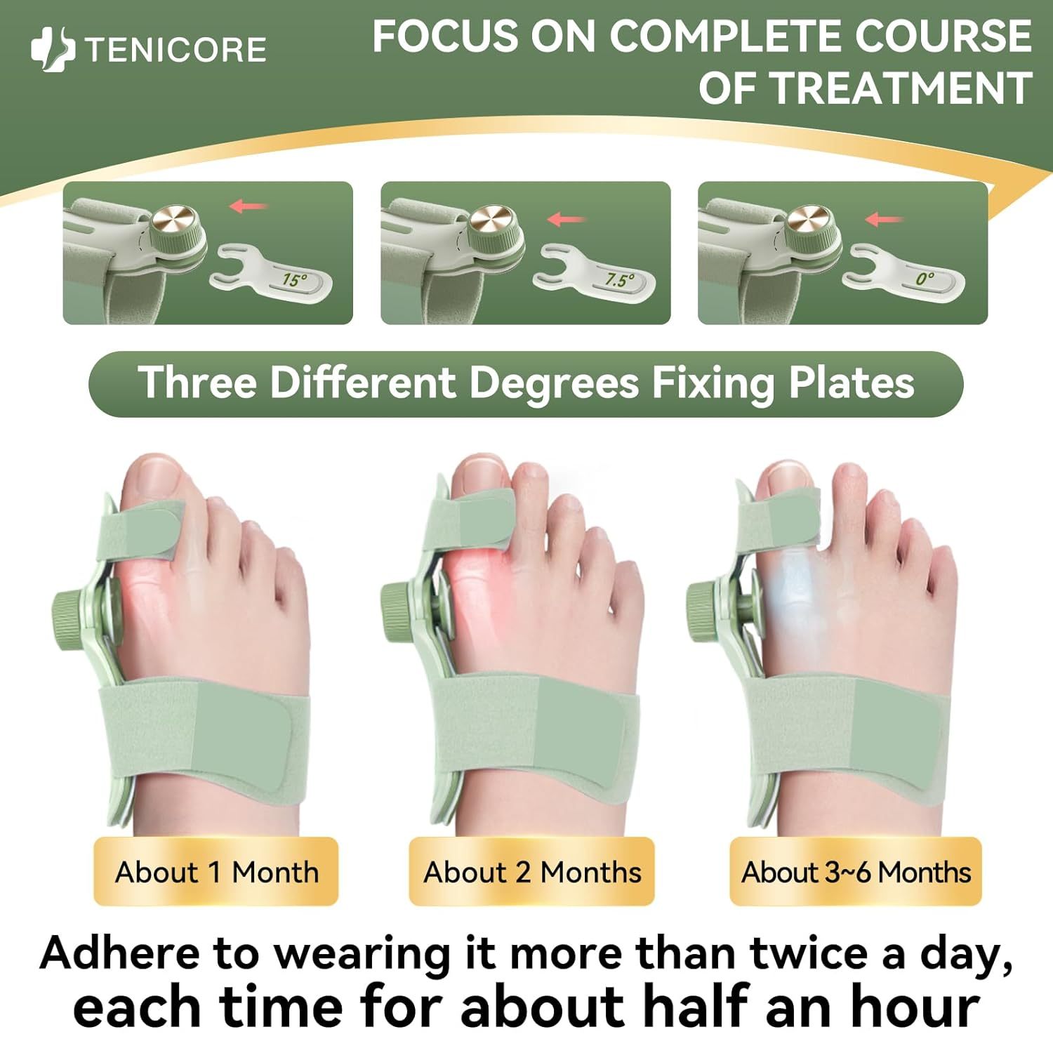 Person using the TENICORE light green bunion corrector with 3 angle plates for progressive treatment