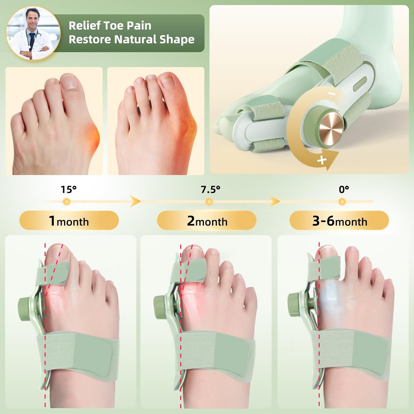 User showing the progressive alignment progress of the light green bunion corrector over 3-6 months