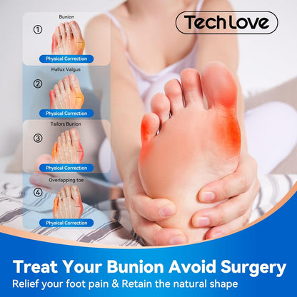 A podiatrist is pointing to four correctable foot problems—hallux valgus, little toe bursitis, overlapping toes, and other foot deformities—and conveying the core message of "avoiding surgery, relieving pain, and restoring natural shape," providing patients with a reassuring alternative to surgery.